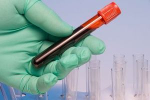 Photo of blood test results