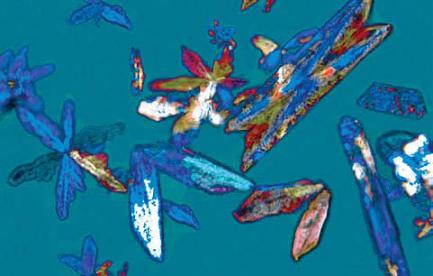 Picture of struvite crystals